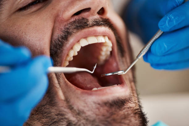 Best Emergency Tooth Extraction in Andrews, SC