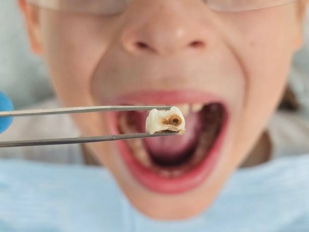 Best Walk-In Emergency Dentist in Andrews, SC