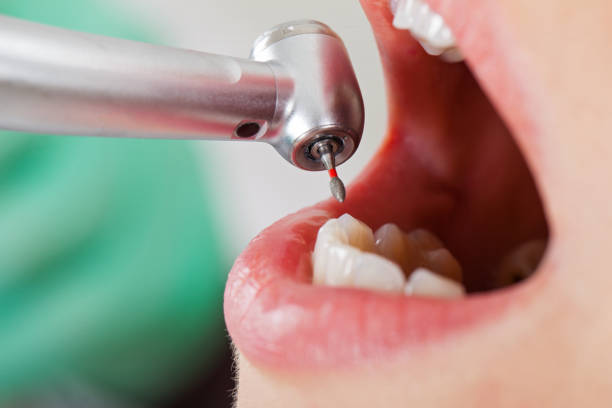 Best Emergency Dental Care for Trauma or Injury in Andrews, SC